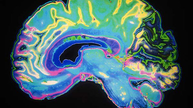 Image of a brain